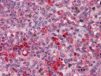 Immunohistochemistry-Paraffin: Fgr Antibody (6G2) - BSA Free [NBP1-47536]