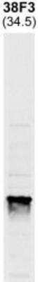 Western Blot: Fibrillarin Antibody (38F3) [NB300-269]