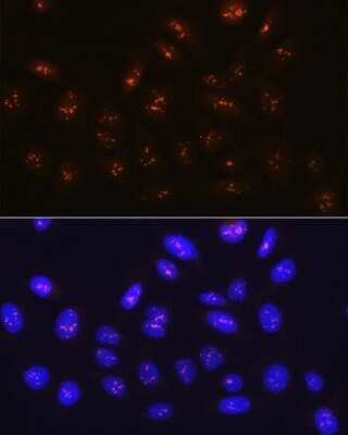 Immunocytochemistry/ Immunofluorescence: Fibrillarin Antibody (9J5O2) [NBP3-15312]