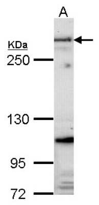 Western Blot: Fibrillin 1 Antibody [NBP2-16493]
