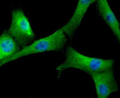 Immunocytochemistry/ Immunofluorescence: Fibrinogen Antibody [NBP2-80414]