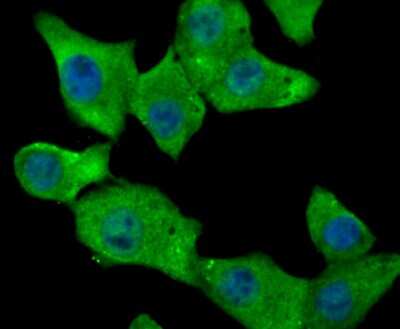 Immunocytochemistry/ Immunofluorescence: Fibrinogen Antibody [NBP2-80414]