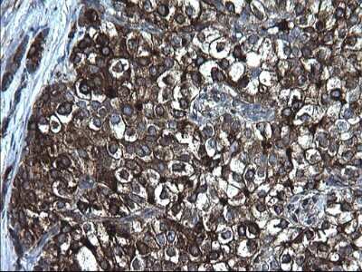 Immunohistochemistry: Fibrinogen gamma chain Antibody (OTI2D2) [NBP2-45663]