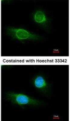 Immunocytochemistry/ Immunofluorescence: Fibrinogen gamma chain Antibody [NBP1-31766]