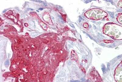Immunohistochemistry: Fibrinogen gamma chain Antibody [NBP1-69291]