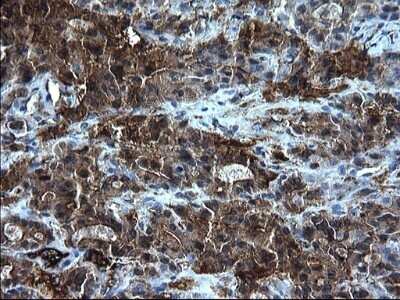 Immunohistochemistry: Fibrinogen gamma chain Antibody (OTI2D2) - Azide and BSA Free [NBP2-70732]