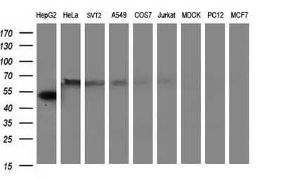 Western Blot: Fibrinogen gamma chain Antibody (OTI2D2)Azide and BSA Free [NBP2-70732]