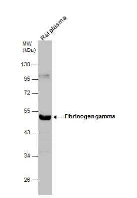 Western Blot: Fibrinogen gamma chain Antibody [NBP1-32436]