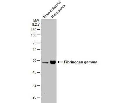 Western Blot: Fibrinogen gamma chain Antibody [NBP1-32436]