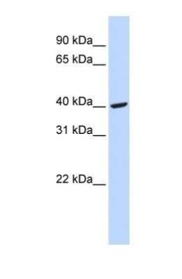 Western Blot: Fibrinogen gamma chain Antibody [NBP1-69291]