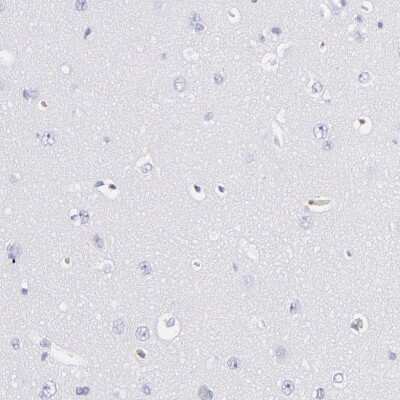 Immunohistochemistry-Paraffin: Fibrinogen beta chain Antibody [NBP1-90955]