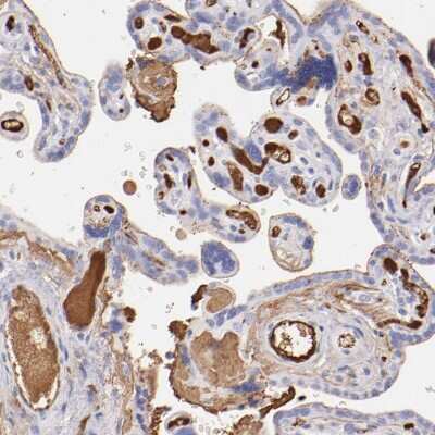 Immunohistochemistry-Paraffin: Fibrinogen beta chain Antibody [NBP1-90955]