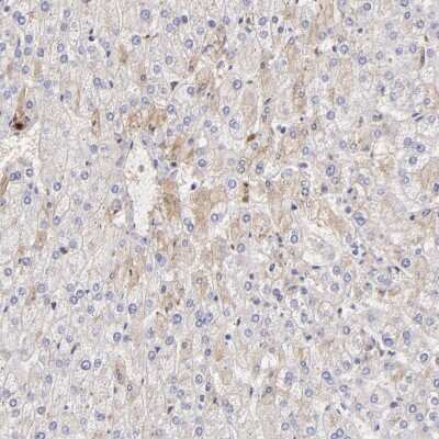 Immunohistochemistry-Paraffin: Fibrinogen beta chain Antibody [NBP1-90955]
