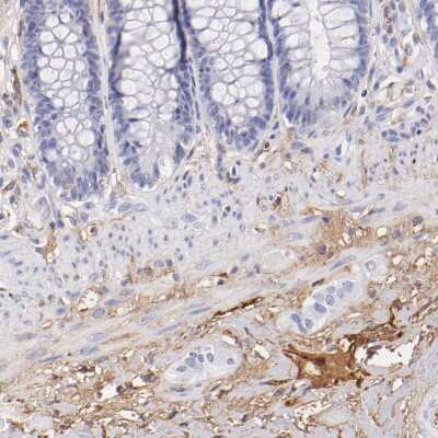 Immunohistochemistry-Paraffin: Fibrinogen beta chain Antibody [NBP1-90955]