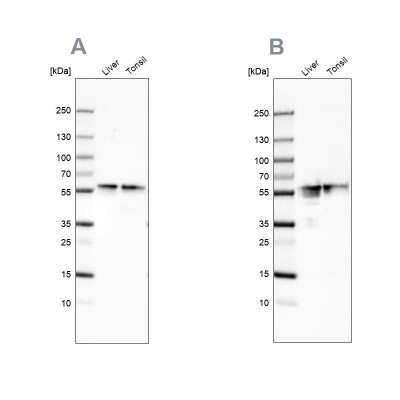 Western Blot: Fibrinogen beta chain Antibody [NBP1-90955]