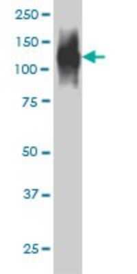 Western Blot: Fibroblast Activation Protein alpha/FAP Antibody (1E5) [H00002191-M01]