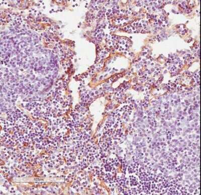 Immunohistochemistry-Frozen: Fibroblast Antibody (ER-TR7) - BSA Free [NB100-64932]