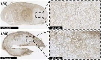 Immunohistochemistry: Fibroblast Antibody (ER-TR7) - BSA Free [NB100-64932]
