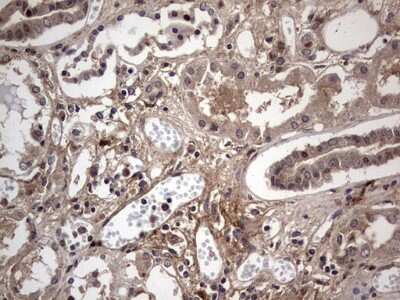 Immunohistochemistry: Fibronectin Antibody (OTI5C1) [NBP2-45690]