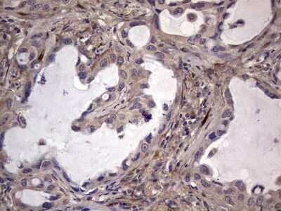 Immunohistochemistry: Fibronectin Antibody (OTI5C1) [NBP2-45690]