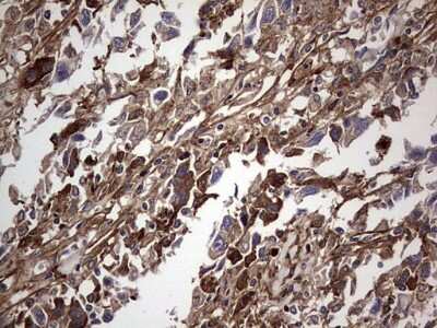 Immunohistochemistry: Fibronectin Antibody (OTI5C1) [NBP2-45690]