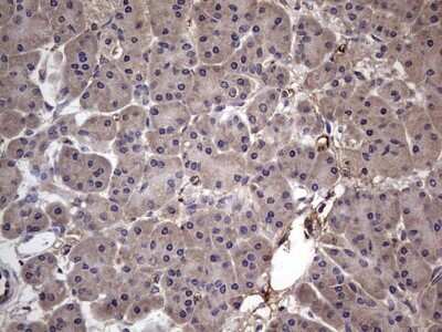 Immunohistochemistry: Fibronectin Antibody (OTI5C1) [NBP2-45690]