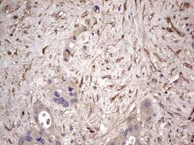 Immunohistochemistry: Fibronectin Antibody (OTI5C1) [NBP2-45690]