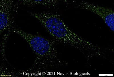 Immunocytochemistry/ Immunofluorescence: Fibronectin Antibody - BSA Free [NBP1-91258]