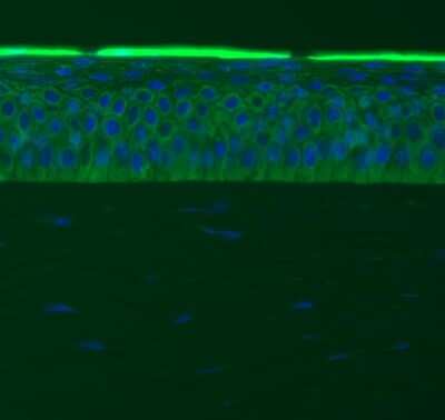 Immunohistochemistry-Frozen: Fibronectin Antibody - BSA Free [NBP1-91258]
