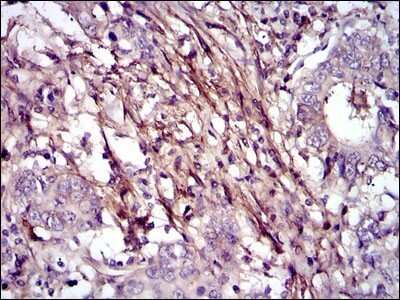 Immunohistochemistry-Paraffin: Fibronectin Antibody (2F4) - Azide and BSA Free [NBP2-80737]