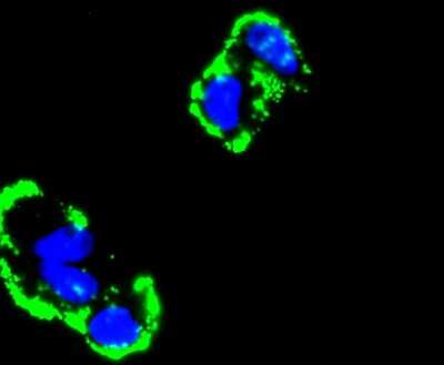 Immunocytochemistry/ Immunofluorescence: Fibronectin Antibody (JF0582) [NBP2-66845]