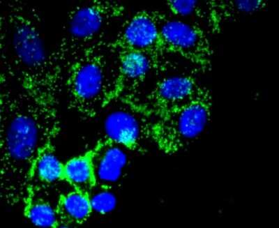 Immunocytochemistry/ Immunofluorescence: Fibronectin Antibody (JF0582) [NBP2-66845]
