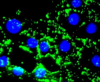 Immunocytochemistry/ Immunofluorescence: Fibronectin Antibody (JF0582) [NBP2-66845]