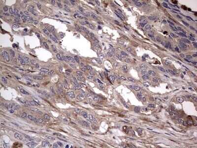Immunohistochemistry: Fibronectin Antibody (OTI5C1) - Azide and BSA Free [NBP2-70762]