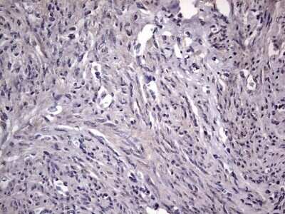 Immunohistochemistry: Fibronectin Antibody (OTI5C1) - Azide and BSA Free [NBP2-70762]