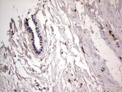 Immunohistochemistry: Fibronectin Antibody (OTI5C1) - Azide and BSA Free [NBP2-70762]