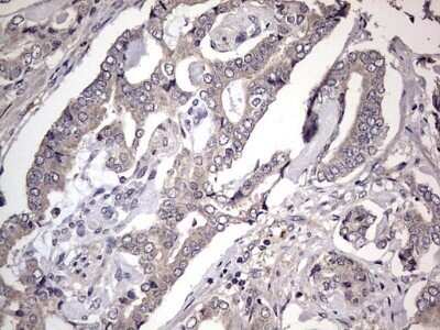 Immunohistochemistry: Fibronectin Antibody (OTI5C1) - Azide and BSA Free [NBP2-70762]