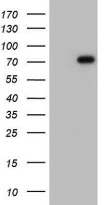 Western Blot: Fibronectin Antibody (OTI5C1)Azide and BSA Free [NBP2-70762]