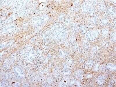 Immunohistochemistry-Paraffin: Fibronectin Antibody (SPM539) - Azide and BSA Free [NBP2-34785]