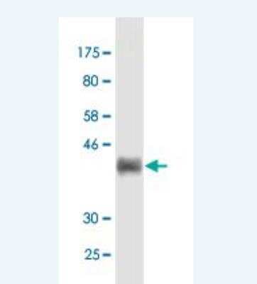 Western Blot: Fibulin 1 Antibody (2G9) [H00002192-M02]