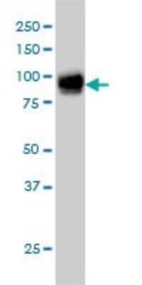 Western Blot: Fibulin 1 Antibody (4C9) [H00002192-M01]