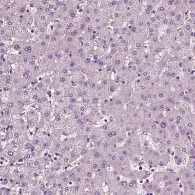 Immunohistochemistry-Paraffin: Fibulin 1 Antibody (CL0337) [NBP2-52918]
