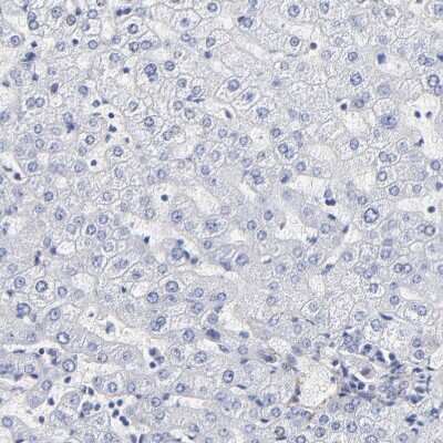 Immunohistochemistry-Paraffin: Fibulin 2 Antibody [NBP1-88115]