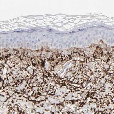 Immunohistochemistry-Paraffin: Fibulin 2 Antibody [NBP1-88115]