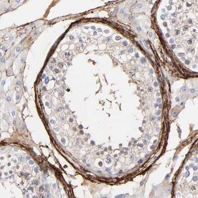 Immunohistochemistry-Paraffin: Fibulin 2 Antibody [NBP1-88115]