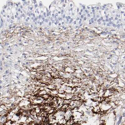 Immunohistochemistry-Paraffin: Fibulin 2 Antibody [NBP1-88115]