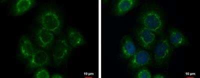 Immunocytochemistry/ Immunofluorescence: Fibulin-3/EFEMP1 Antibody [NBP2-16277]