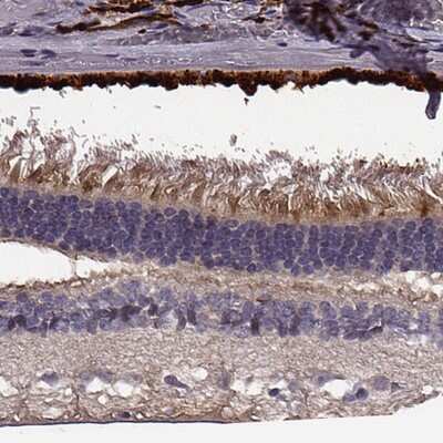 Immunohistochemistry-Paraffin: Fibulin-3/EFEMP1 Antibody [NBP2-57871]