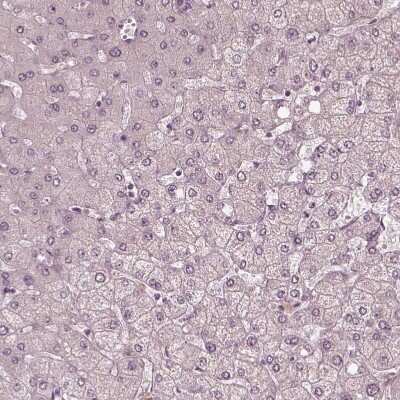 Immunohistochemistry-Paraffin: Fibulin-3/EFEMP1 Antibody [NBP2-57871]
