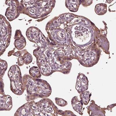 Immunohistochemistry-Paraffin: Fibulin-3/EFEMP1 Antibody [NBP2-57871]